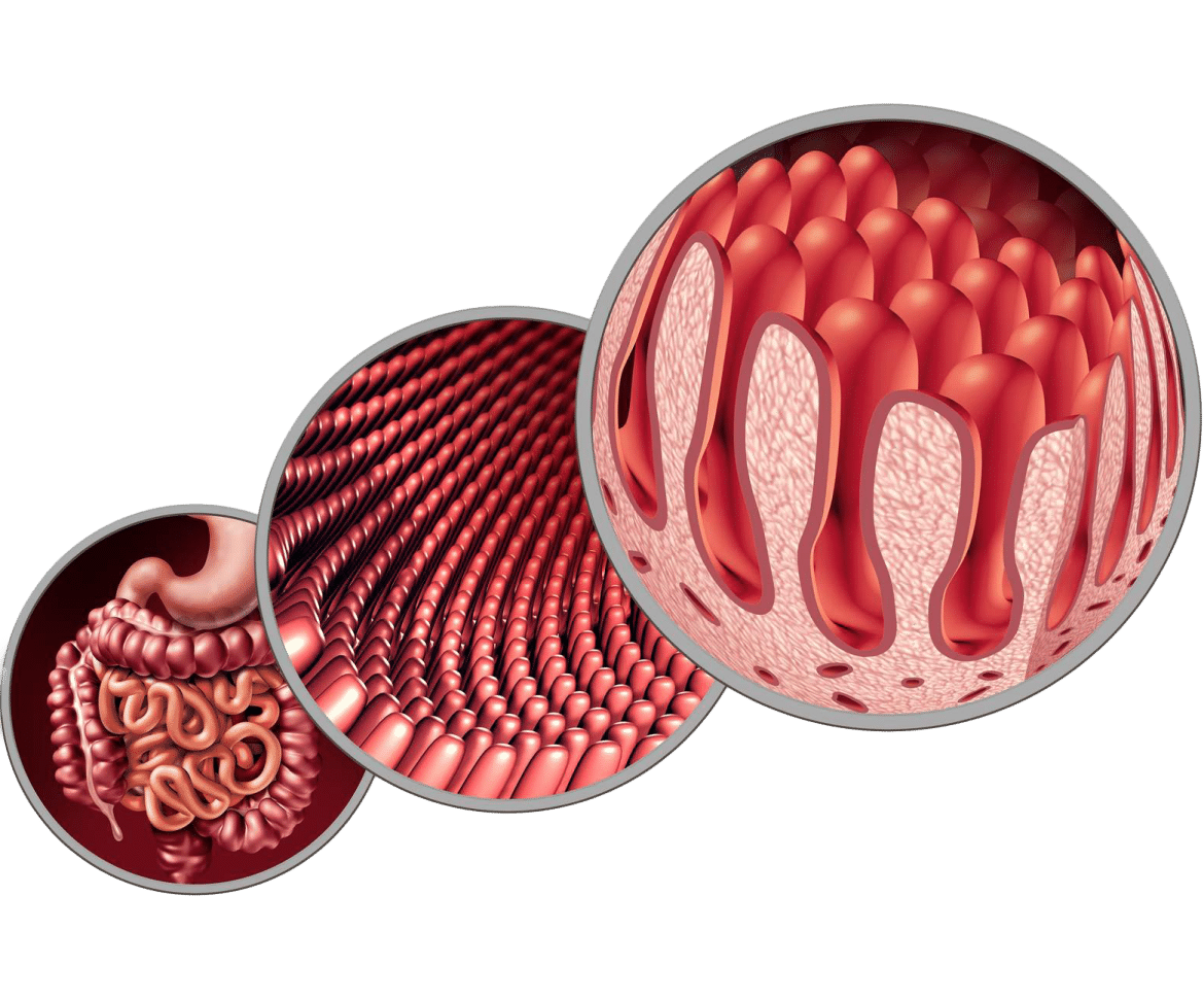 What is Coeliac Disease