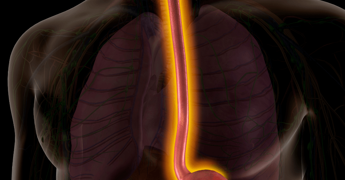 Eosinophilic Oesophagitis Treatment