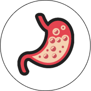 Acid reflux regurgitation