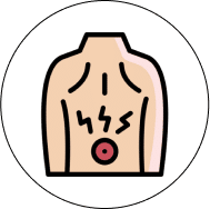 Gastroesophageal reflux disease back pain