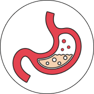 Gastroesophageal reflux with esophagitis